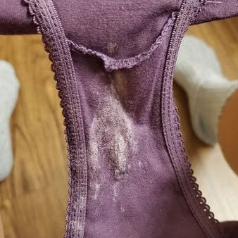 2. Your vagina is naturally acidic enough to lighten fabric.